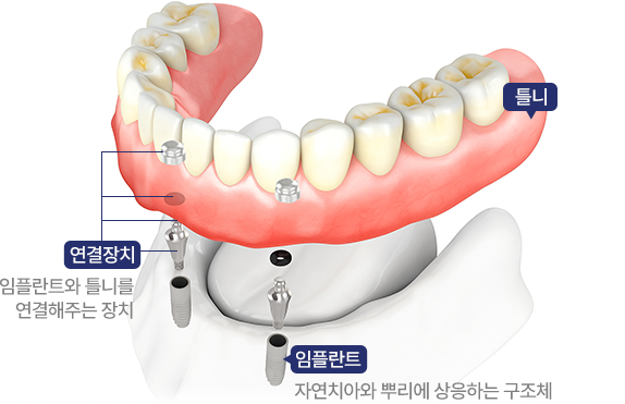 ���ö�Ʈ Ʋ��